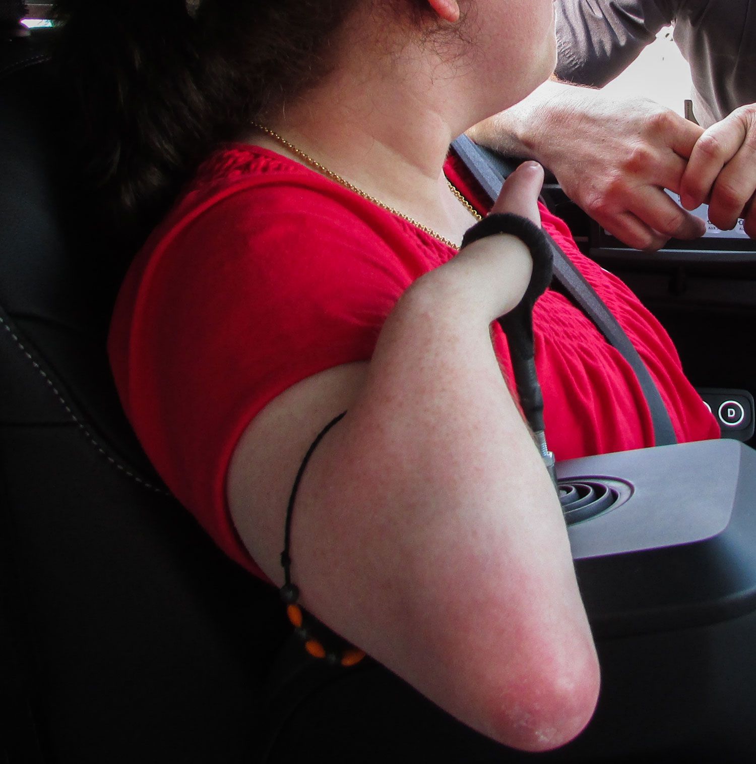 Autofahren mit Amputationen & fehlenden Gliedmaßen